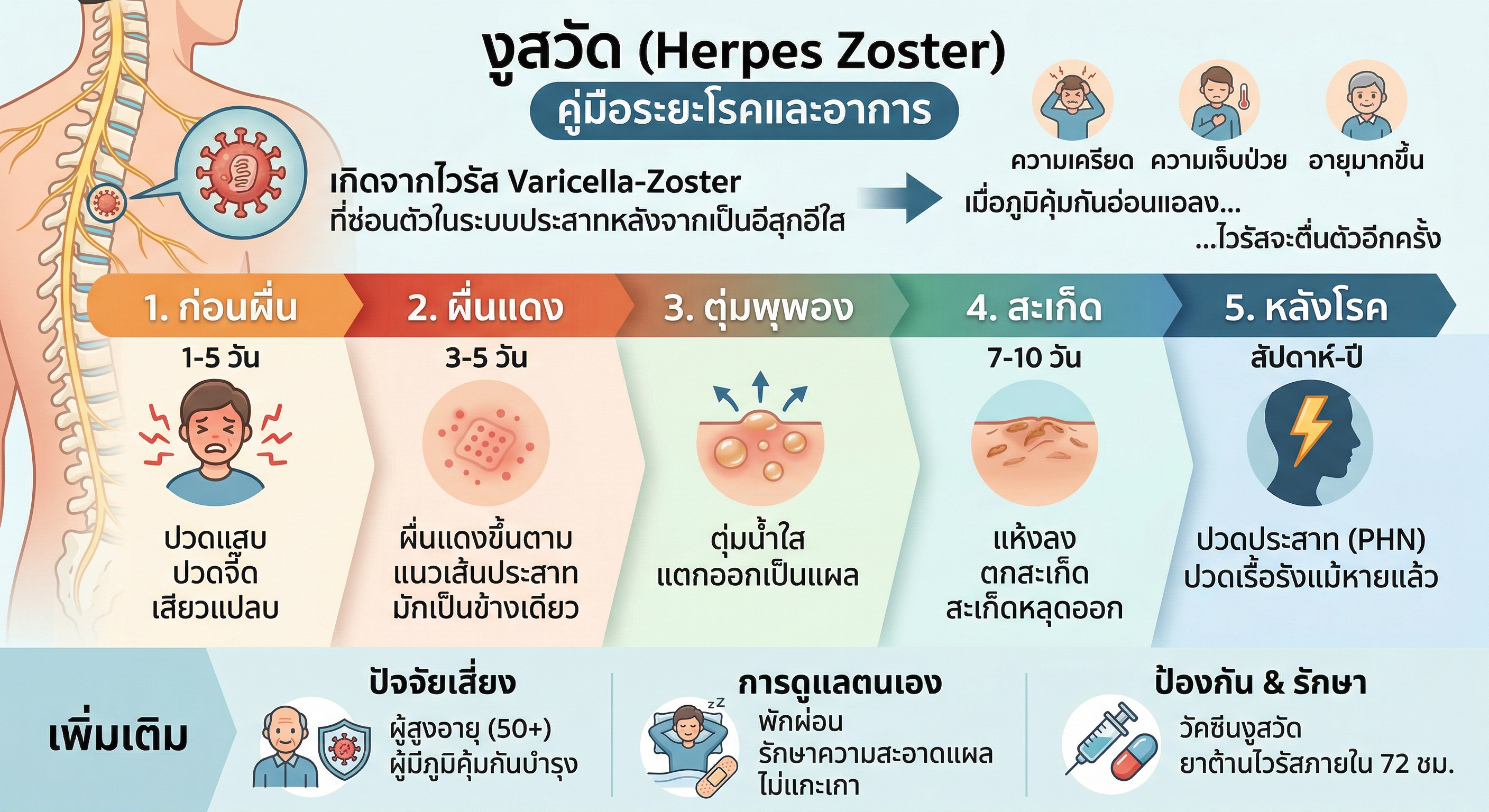 Infographic งูสวัด Herpes Zoster คู่มือระยะโรคและอาการ — เกิดจากไวรัส Varicella-Zoster 5 ระยะ ก่อนผื่น ผื่นแดง ตุ่มพุพอง สะเก็ด หลังโรค